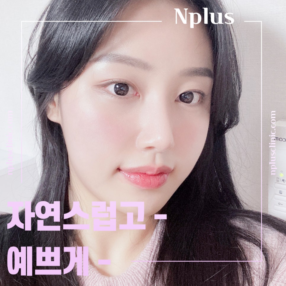 복코수술후기 날렵하고 세련된 라인으로 관련 이미지 2