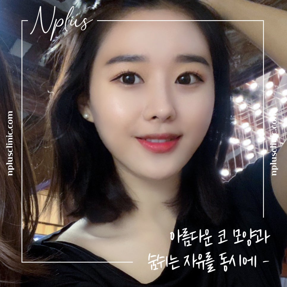 콧볼축소수술 후기까지 확인하고 결정 관련 이미지 1