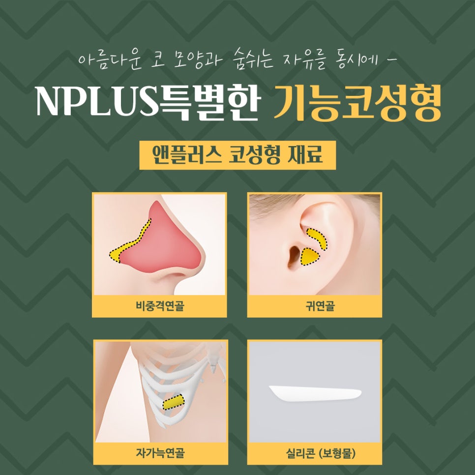 기능코성형후기 꼼꼼하게 알아보고 관련 이미지 11