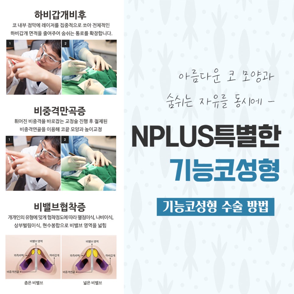 기능코수술후기에 대해 다양하게 알아보고 관련 이미지 9