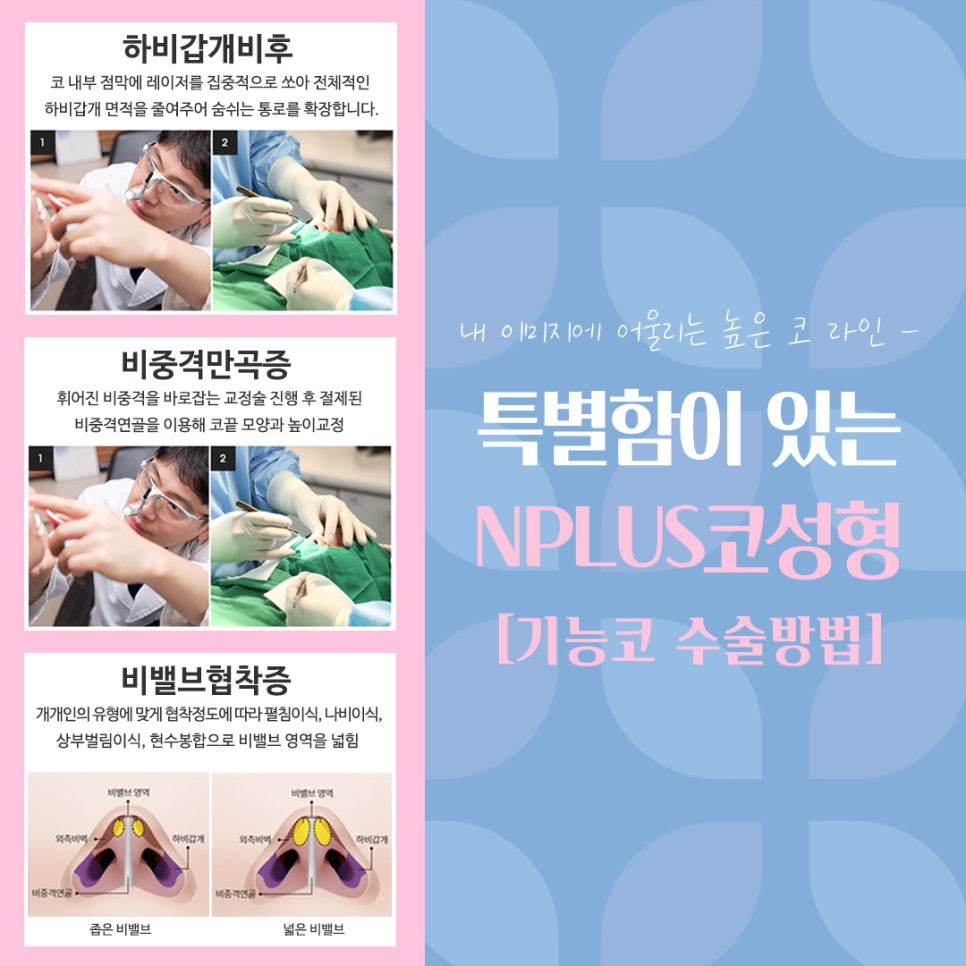 여자코수술후기 코 내부까지 확인하고 관련 이미지 12