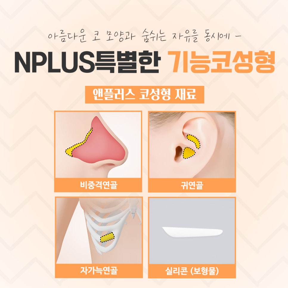 기능코수술후기 자세하게 알아봐야 관련 이미지 10