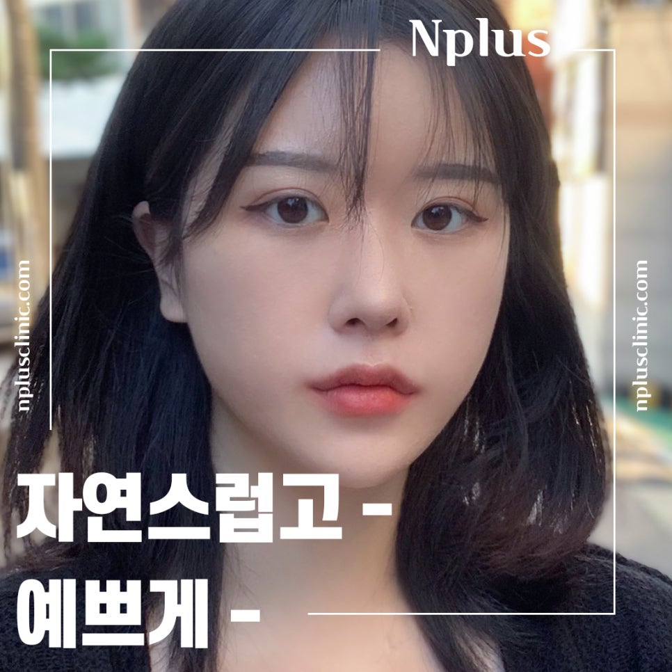 콧볼축소후기 퍼진코에 변화를 관련 이미지 1
