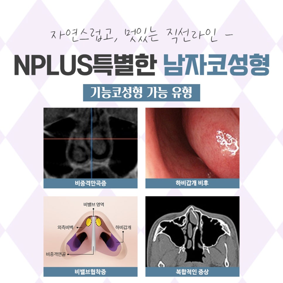 남자코성형후기 자세하게 알아보고 관련 이미지 9