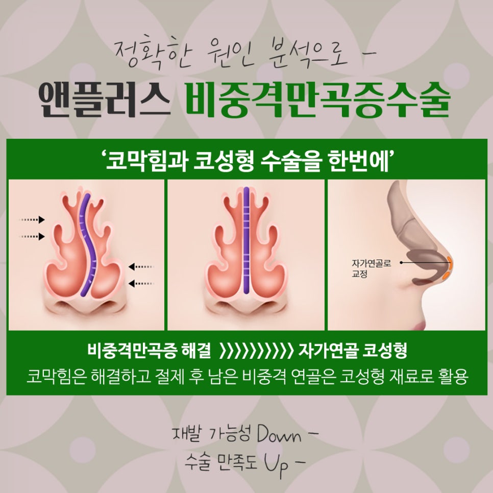 비중격만곡증 수술방법 확인하여 관련 이미지 9