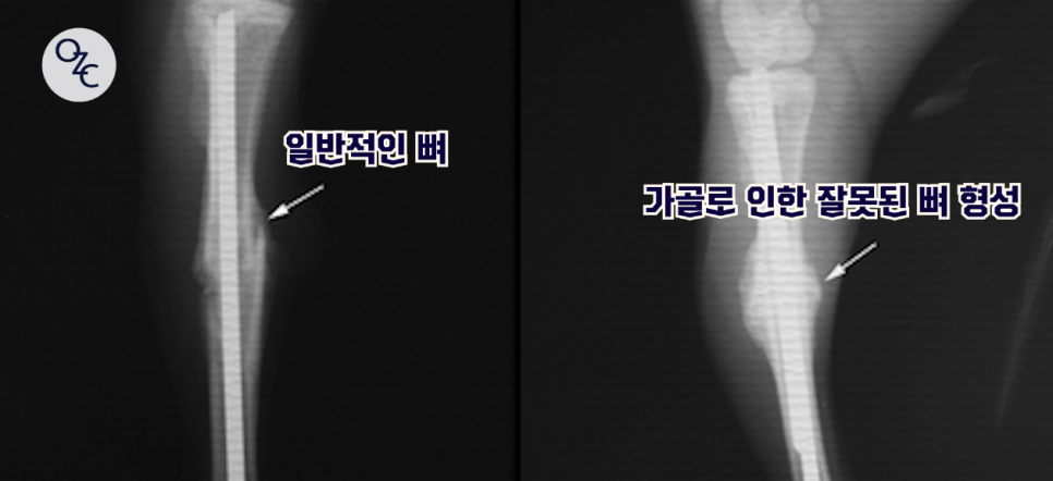 코성형 후에도 매부리재발이 될 수 있나요? 관련 이미지 5