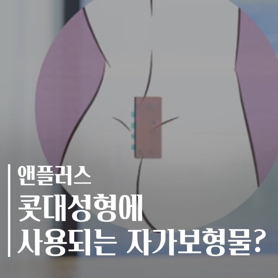 콧대성형에 사용되는 자가보형물 관련 이미지 1