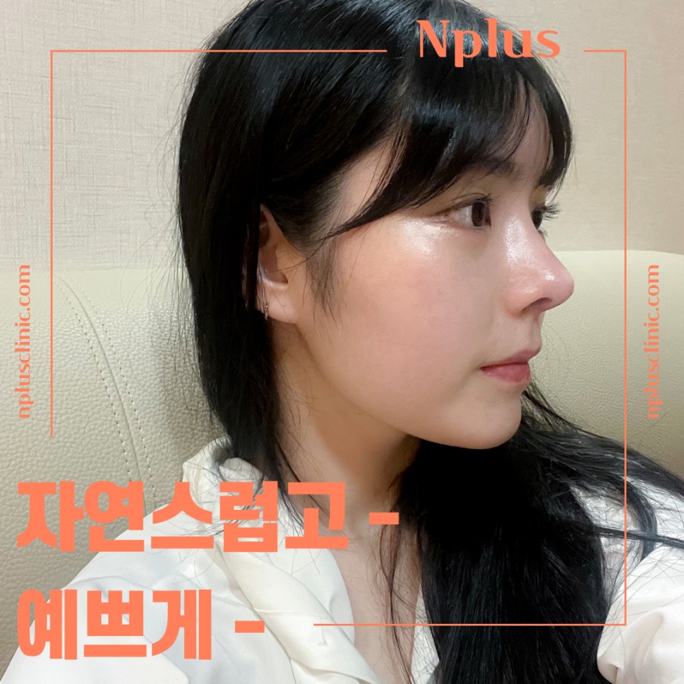 Learn More About Upturned Nose Rhinoplasty in Detail image 4