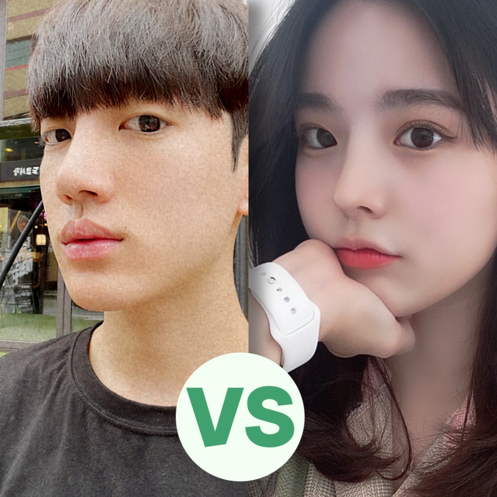 남자코수술후기 멋있고 자연스러운 라인으로 관련 이미지 6