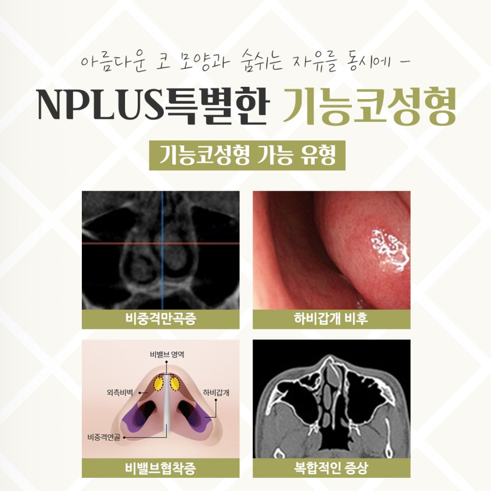 Detailed Information on Functional Rhinoplasty Reviews image 5