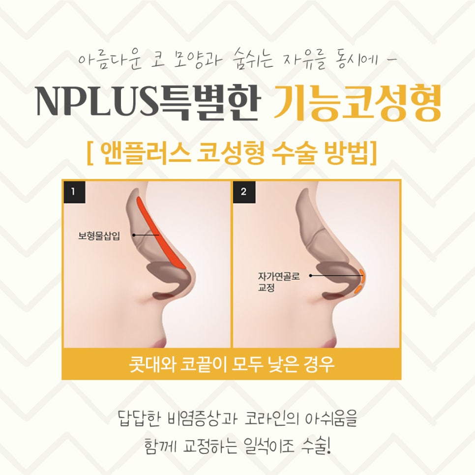 기능코성형후기 이미지를 고려하여 관련 이미지 10