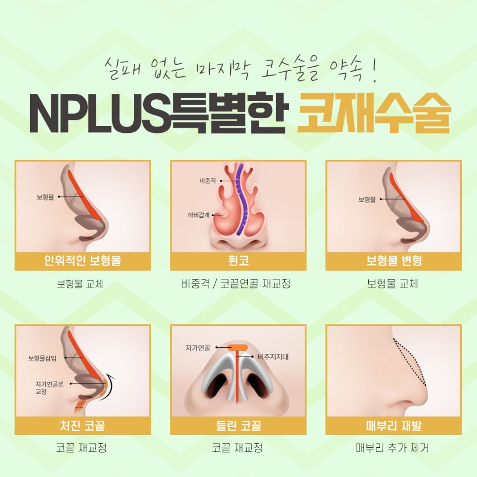 Nose Revision Surgery Review Considering Function as Well image 10