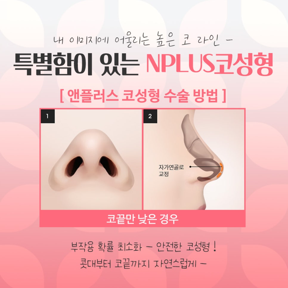 If You’re Looking for Detailed Reviews of Female Rhinoplasty image 10