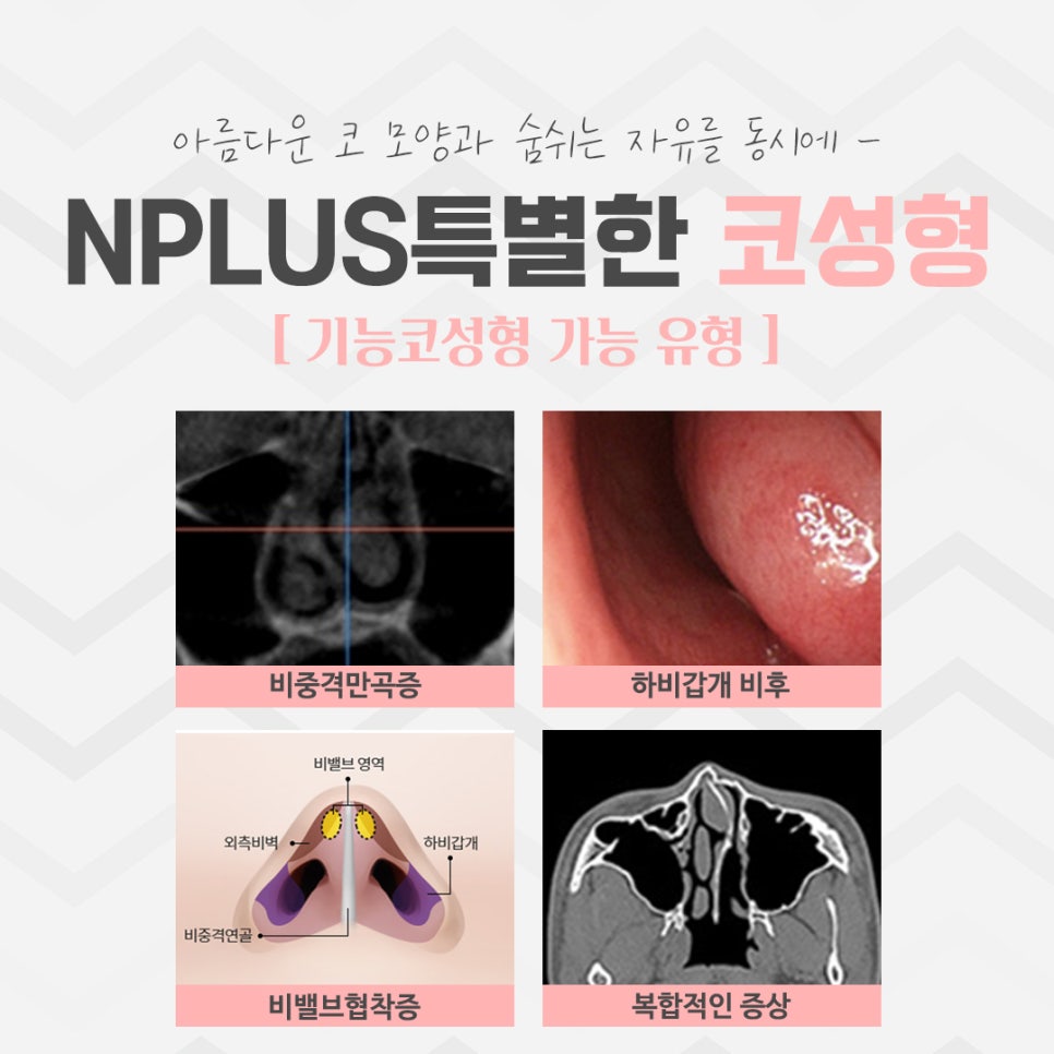 Building Confidence with a Refined Nose Line image 4