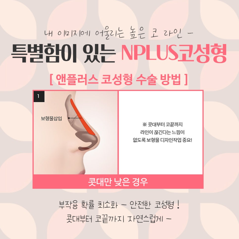여자코수술후기 정확한 진단으로 관련 이미지 9