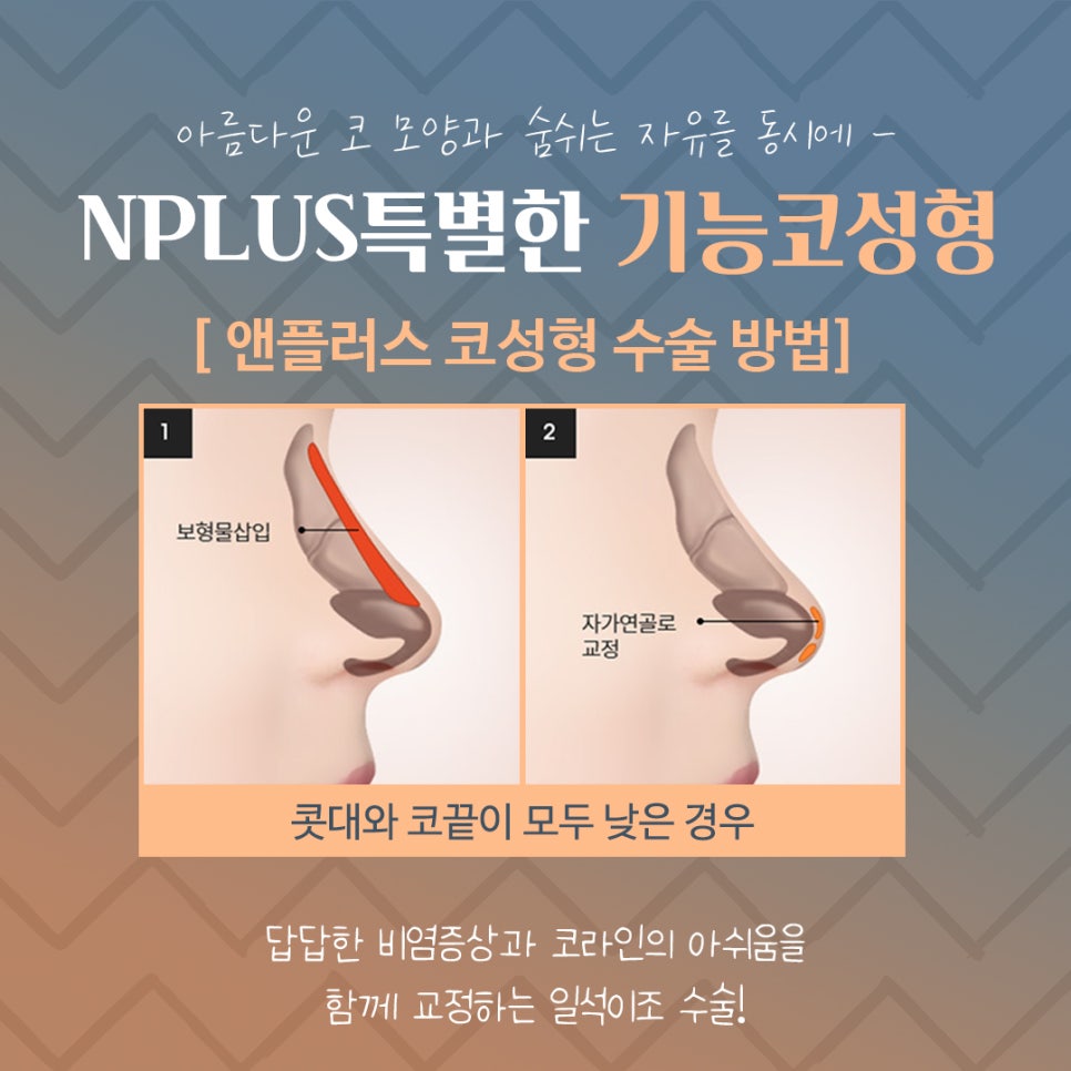 기능코후기에 대한 비교를 찾아보고 관련 이미지 9
