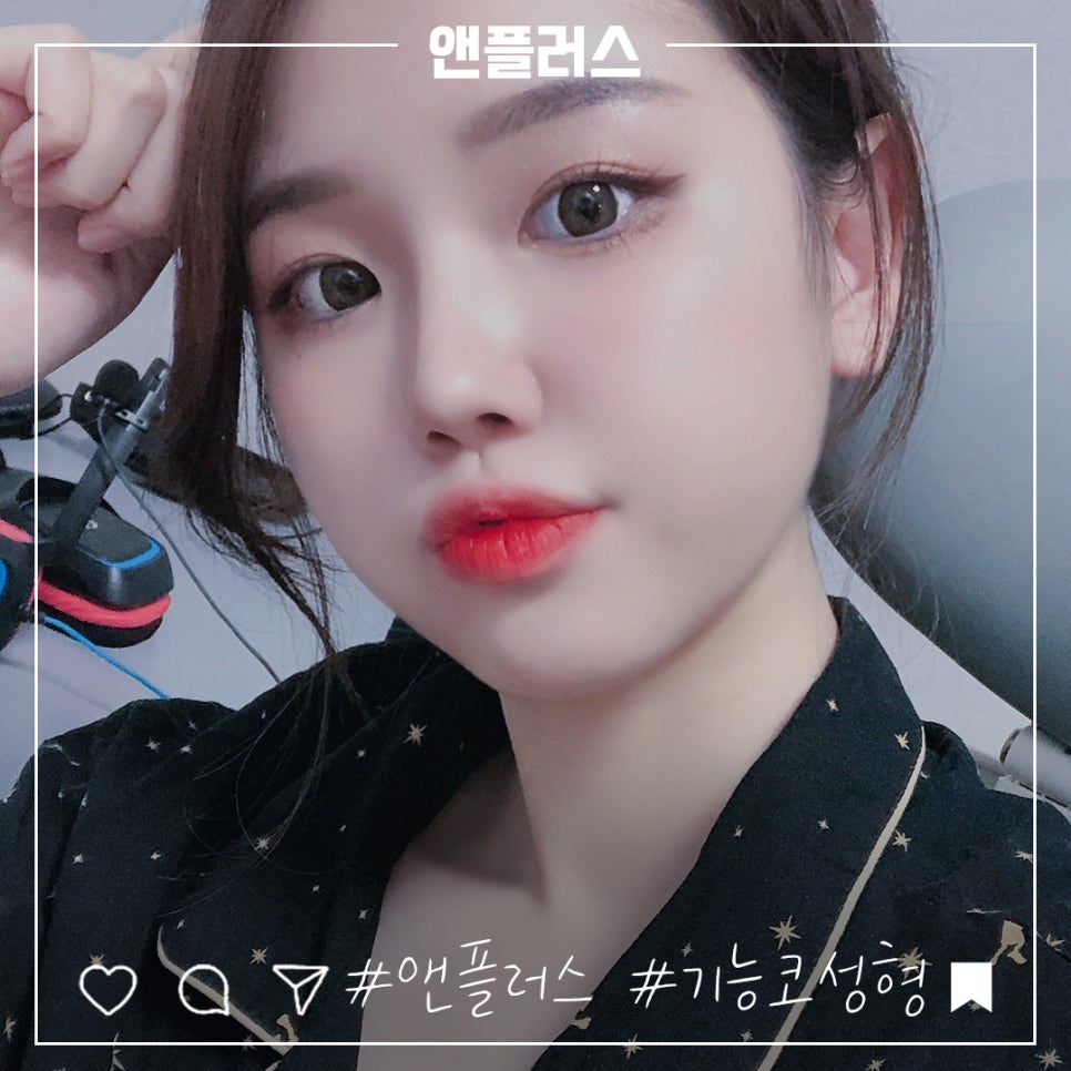 코성형후기 만족스러운 결과 관련 이미지 8