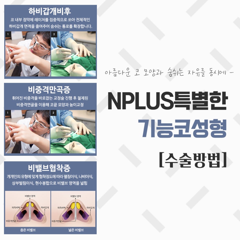 비염코성형실비 꼼꼼하게 체크하고 관련 이미지 8