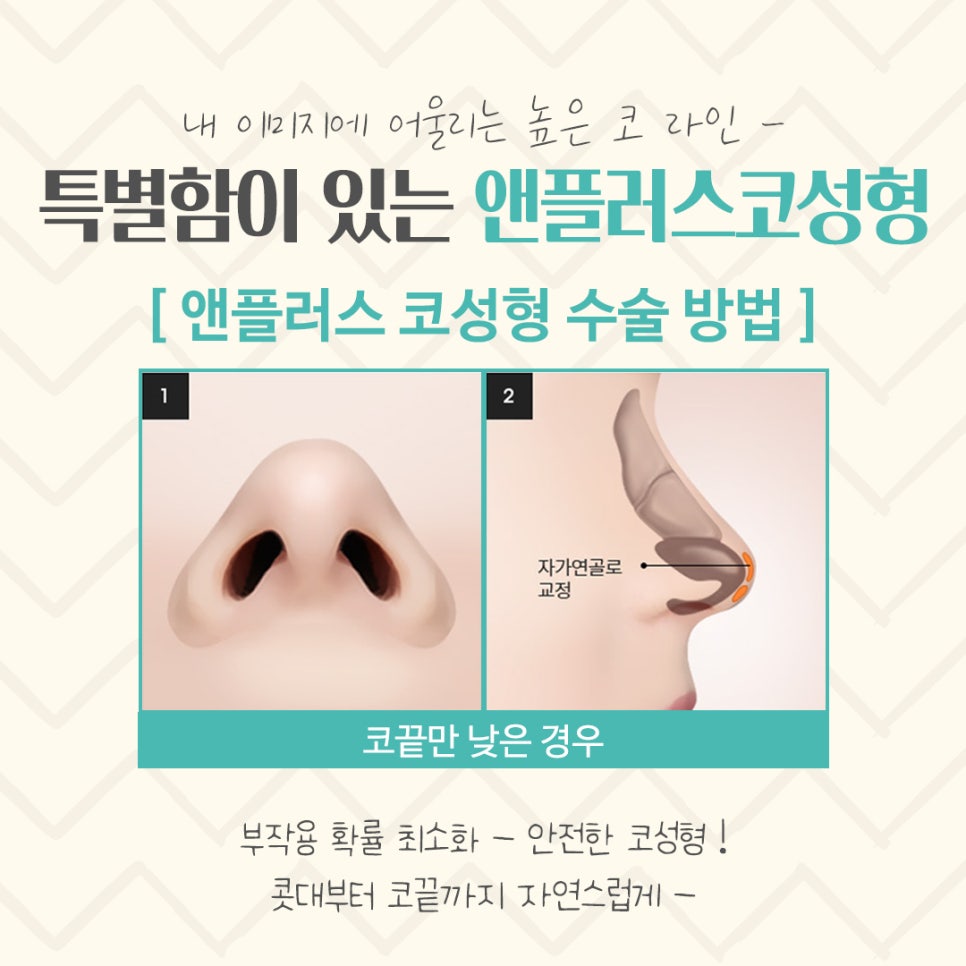 코수술후기 자세하게 알아보고 판단 관련 이미지 9