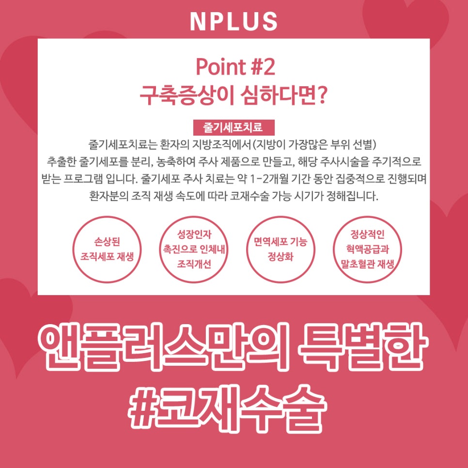 압구정성형외과_코재수술 본인 얼굴에 맞게 선택 관련 이미지 6