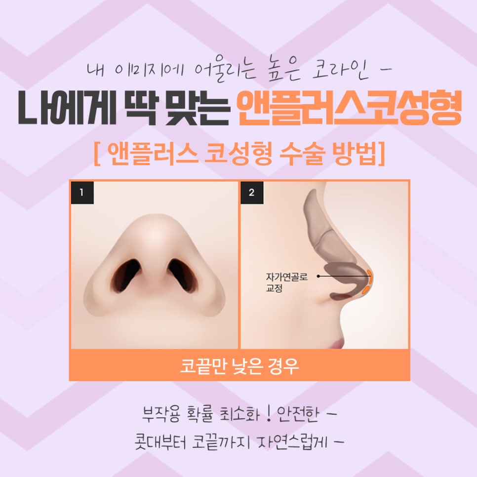 코수술후기 코 내부까지 확실하게 알아보고 관련 이미지 10