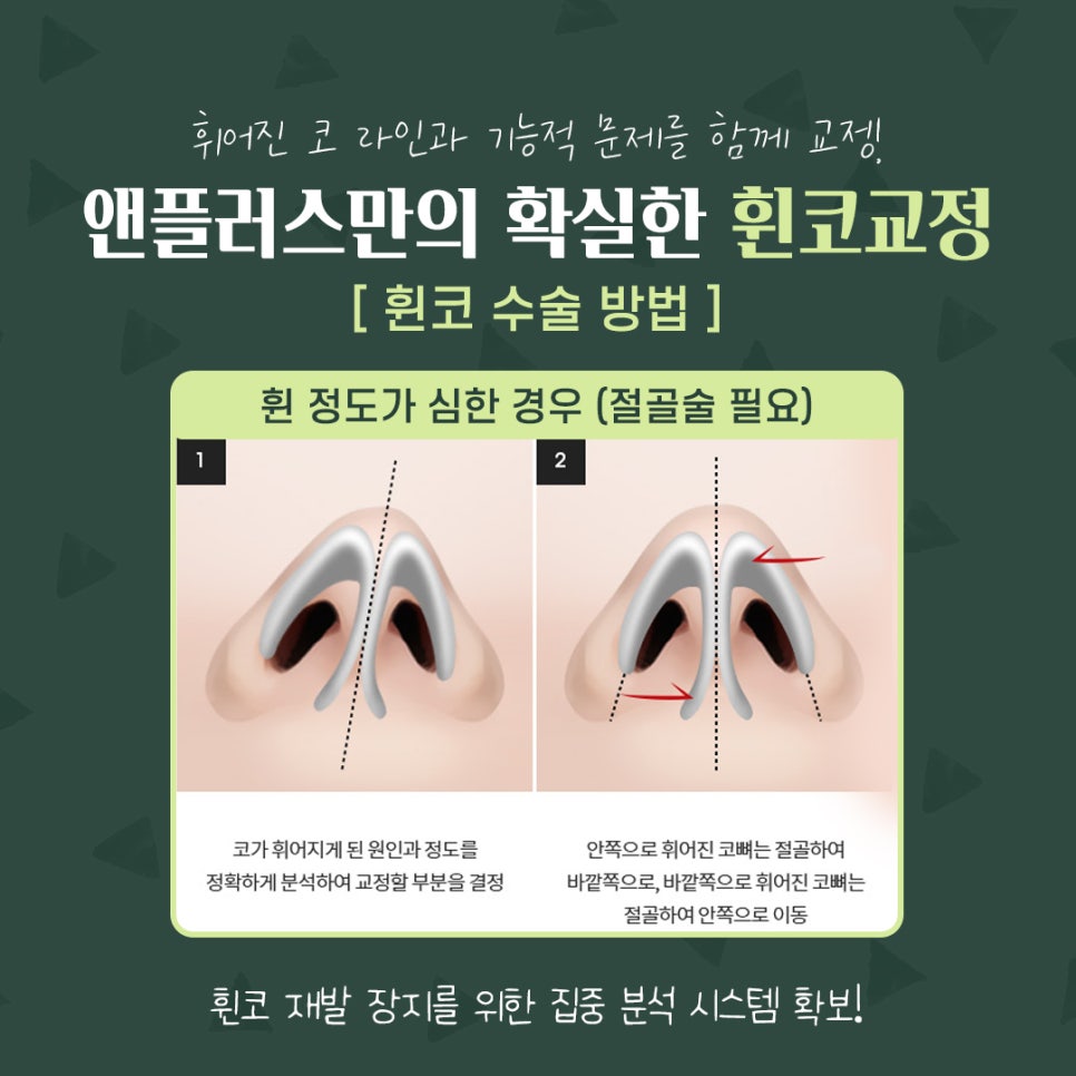 A Thorough Analysis for Reliable Crooked Nose Correction Reviews image 8
