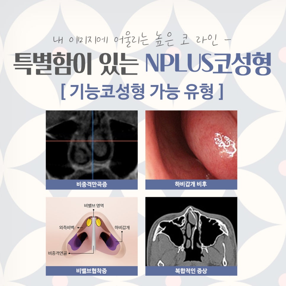 코수술후기 기능까지 확인하고 관련 이미지 5