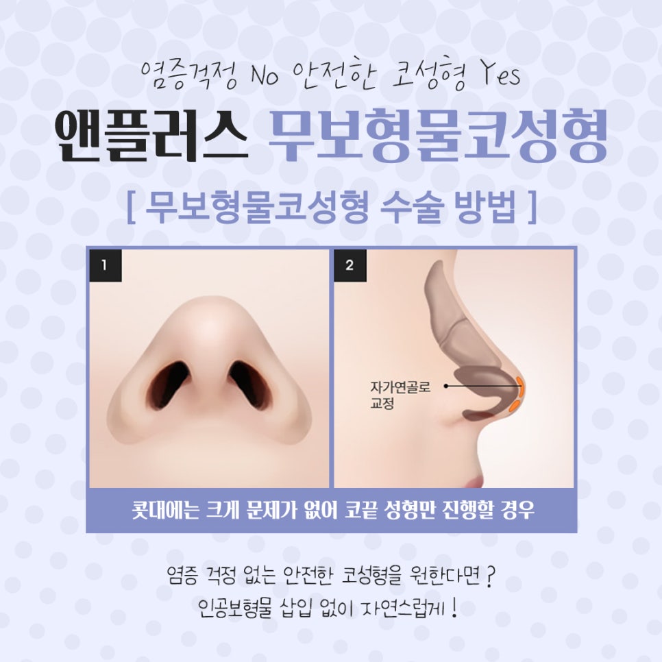Review of Non-Implant Nose Surgery for a Beautiful Line image 10