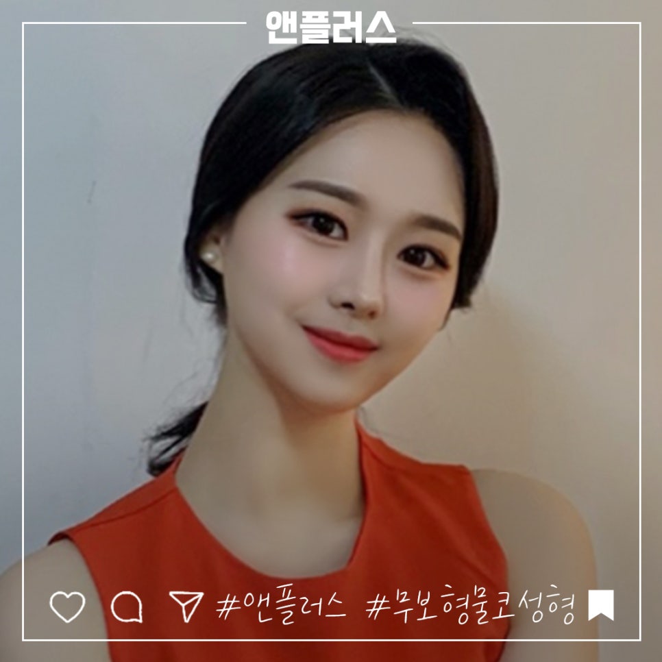 무보형물코수술 자연스러운 코 라인을 원한다면! 관련 이미지 1