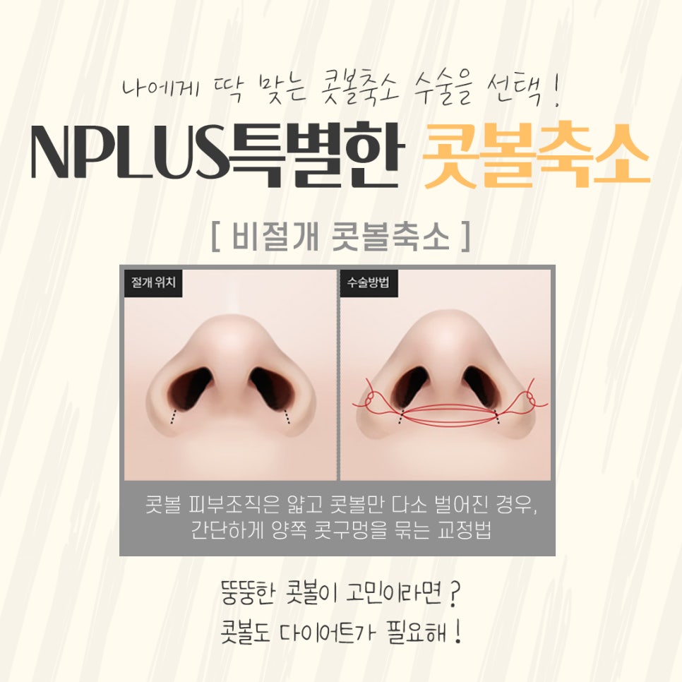콧볼축소후기 자세하게 확인하여 관련 이미지 8