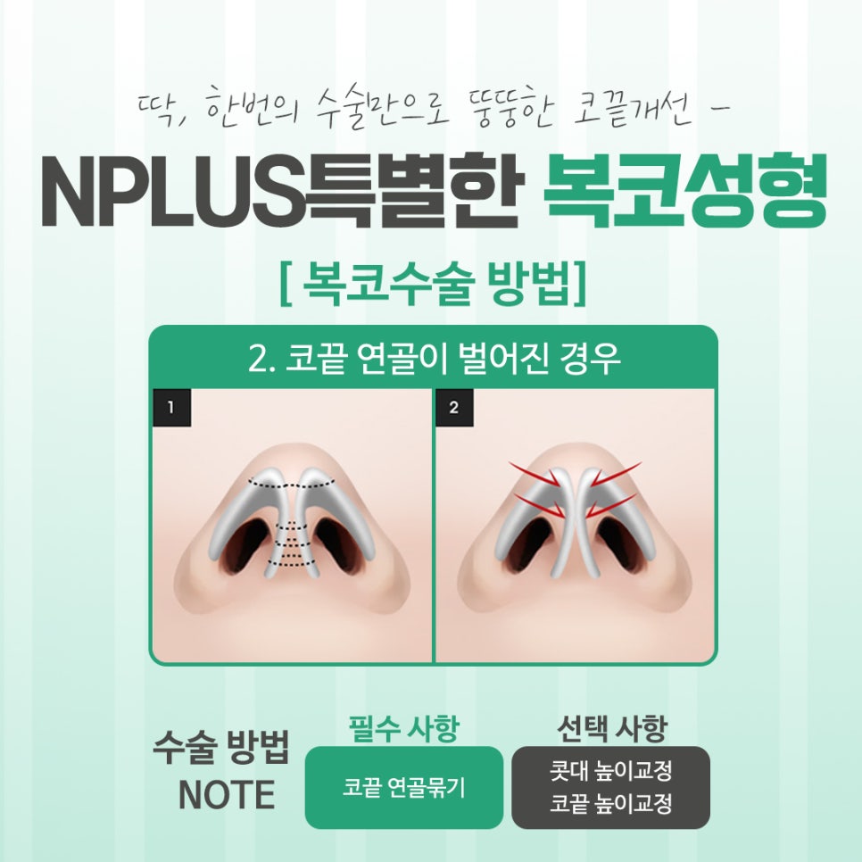 Looking into Various Bulbous Nose Surgery Reviews image 8