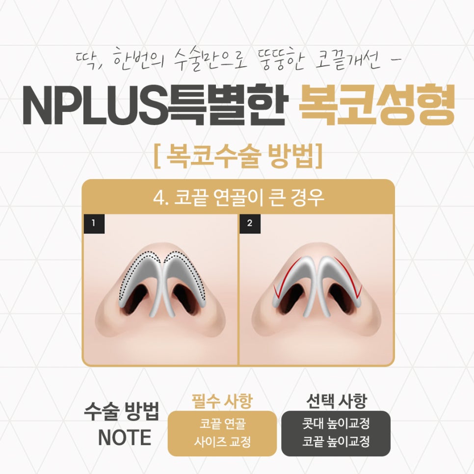 Taking a Thorough Look at Bulbous Nose Surgery Reviews image 10