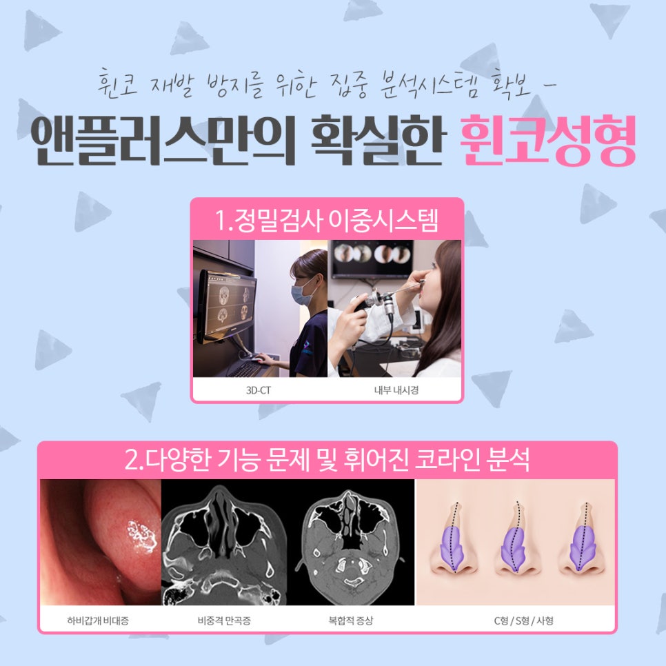 휜코성형 정확한 문제 파악으로 관련 이미지 7