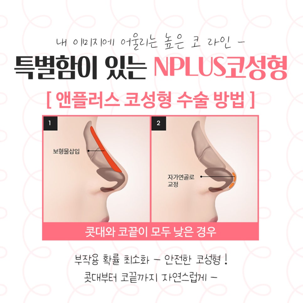 코수술후기 정확한 진단으로 관련 이미지 7