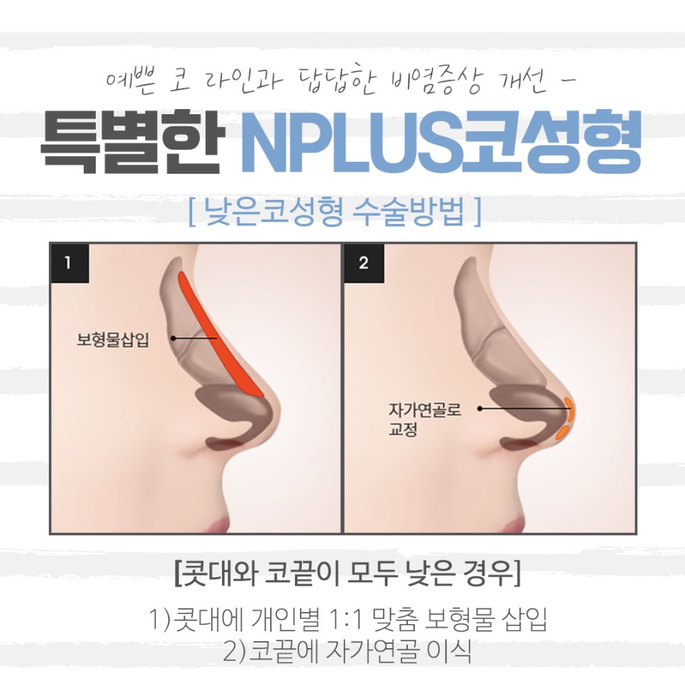 Looking Into Low Nose Rhinoplasty to Improve Your Image image 7