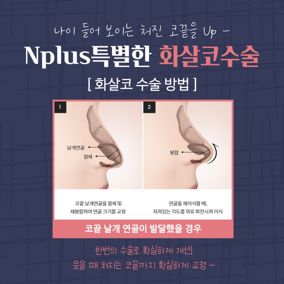 Transforming Your Look to a More Youthful Appearance After Arrow Nose Surgery image 6