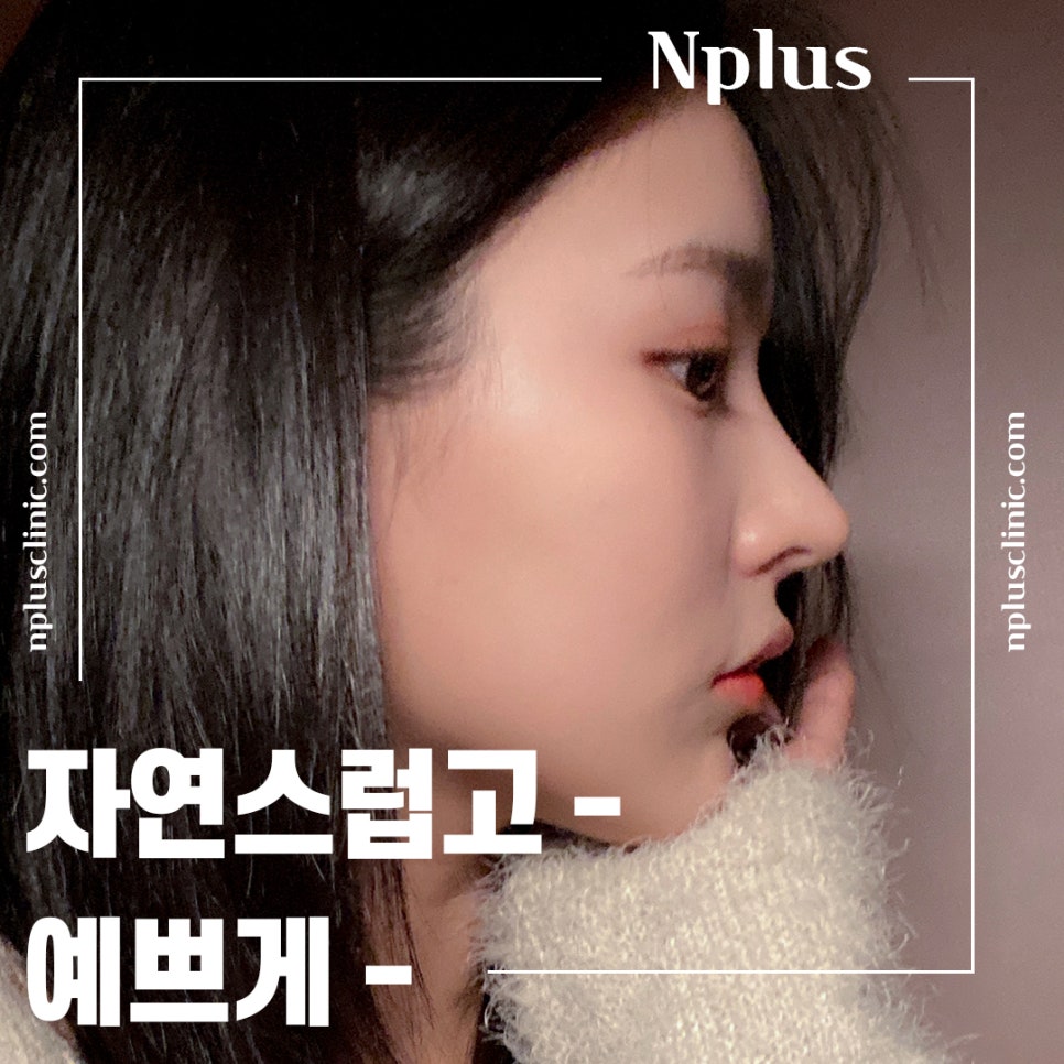 코수술후기 기능까지 확인하고 관련 이미지 1