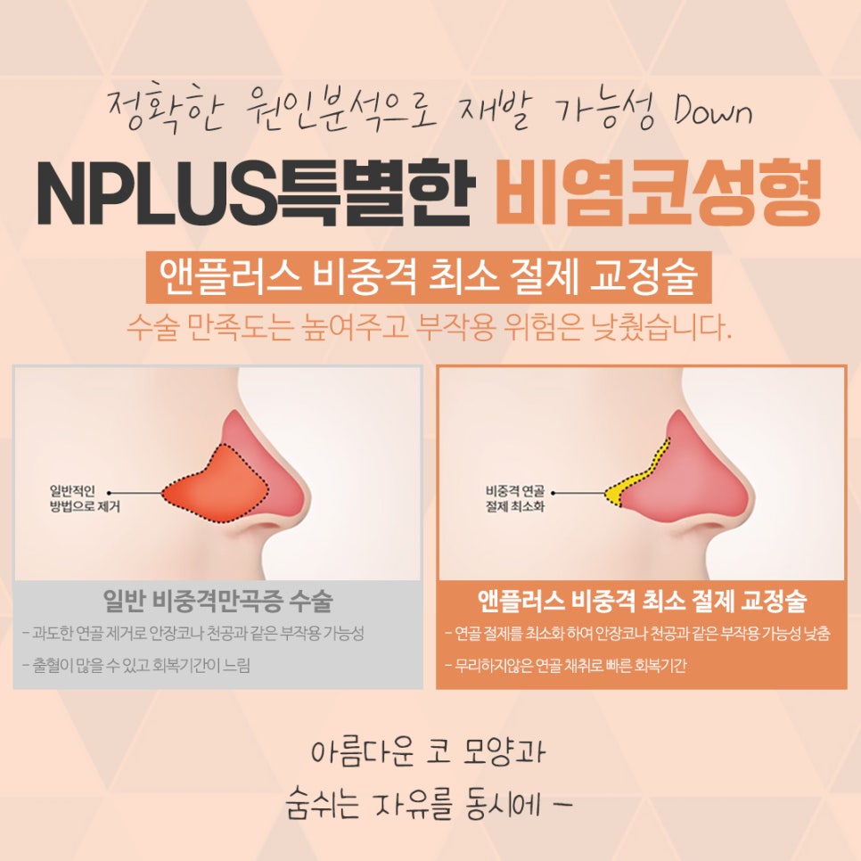 A Satisfying Result with One Rhinoplasty and Rhinitis Surgery image 11
