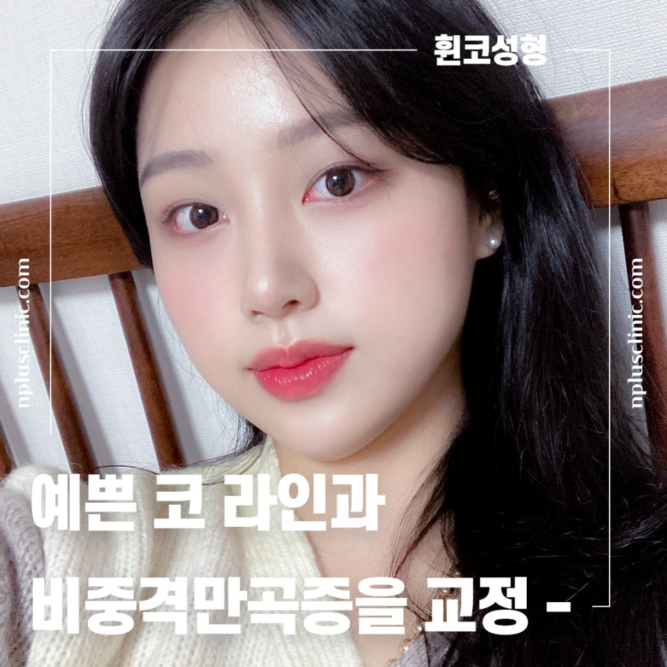 앤플러스에서 알려드리는 성형외과 가을 코수술 이벤트&hearts; 관련 이미지 6