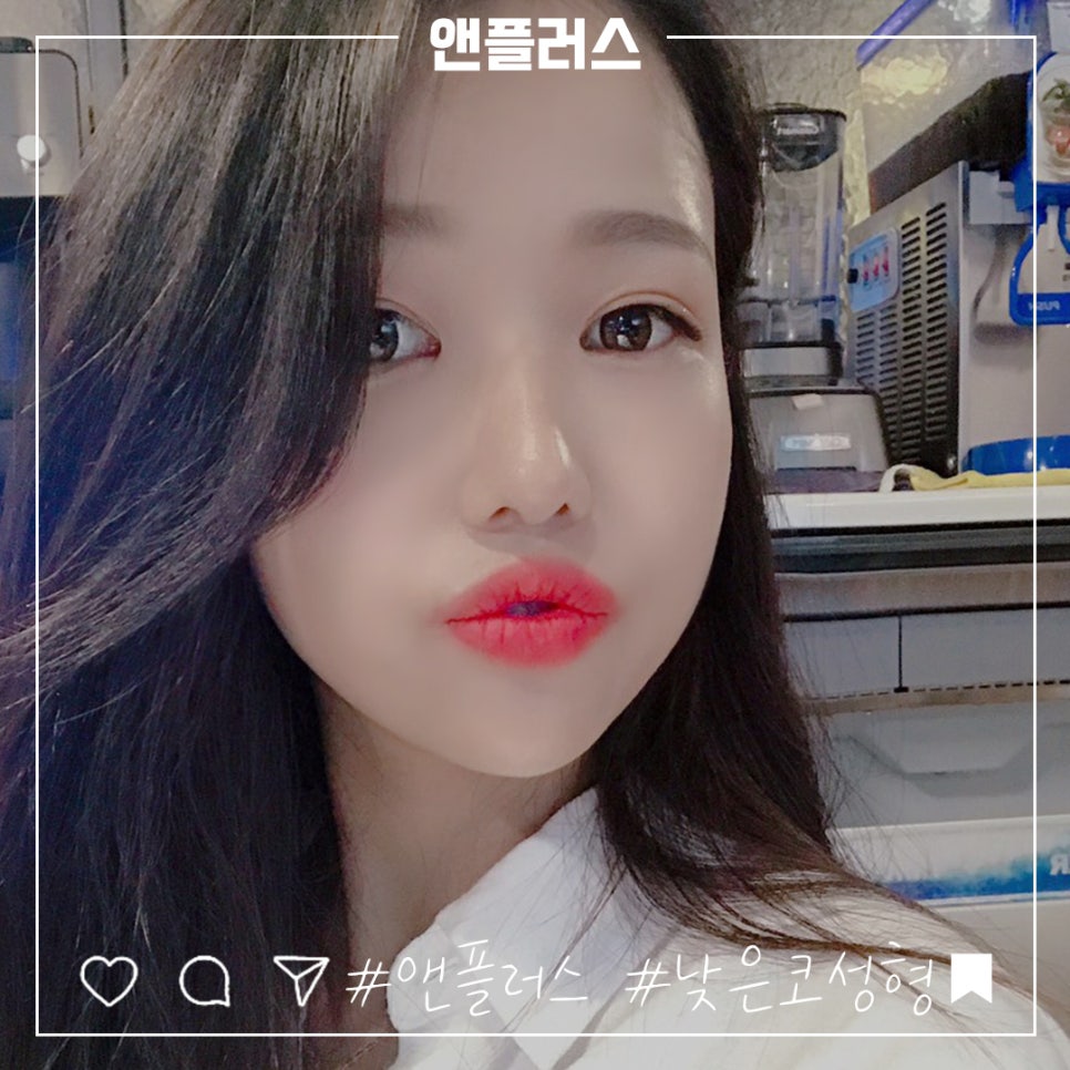 낮은코수술후기 세련된 코라인으로 관련 이미지 6