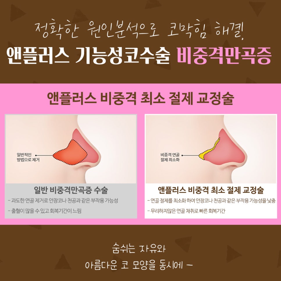 비중격만곡증수술후기 코막힘 고민 해결 관련 이미지 4