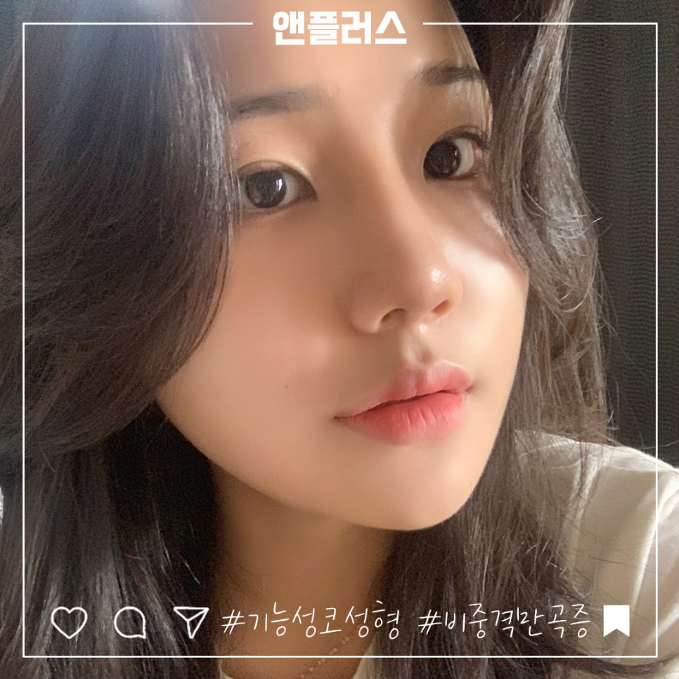 비중격만곡증수술후기 원인과 해결 방법까지 관련 이미지 2