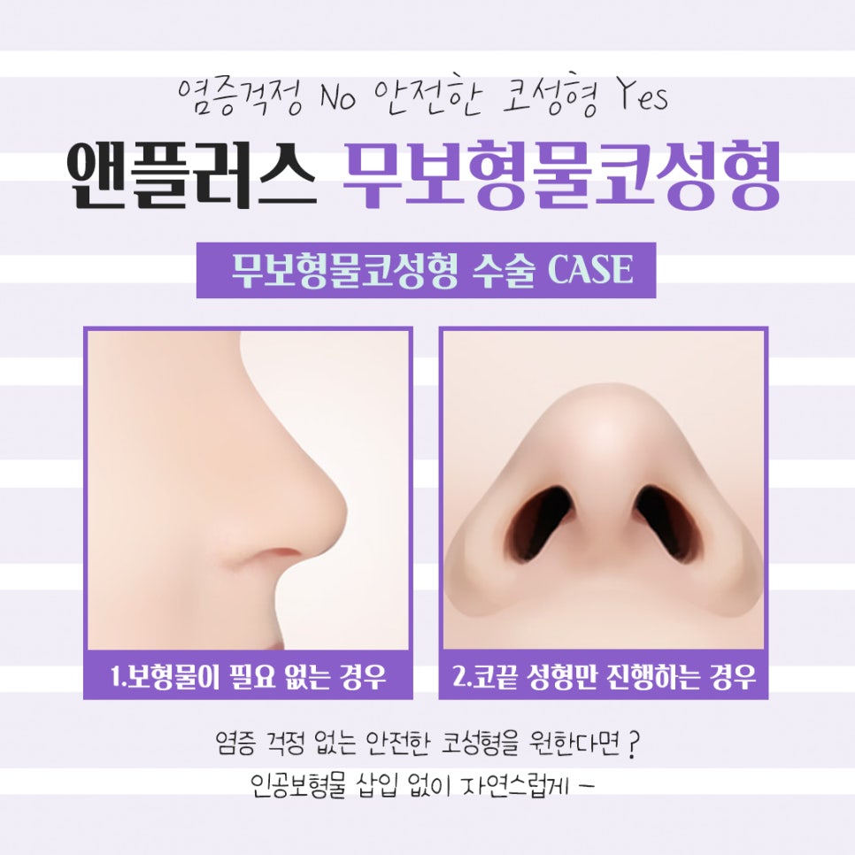 무보형물코성형후기 만족스러운 라인으로 관련 이미지 8