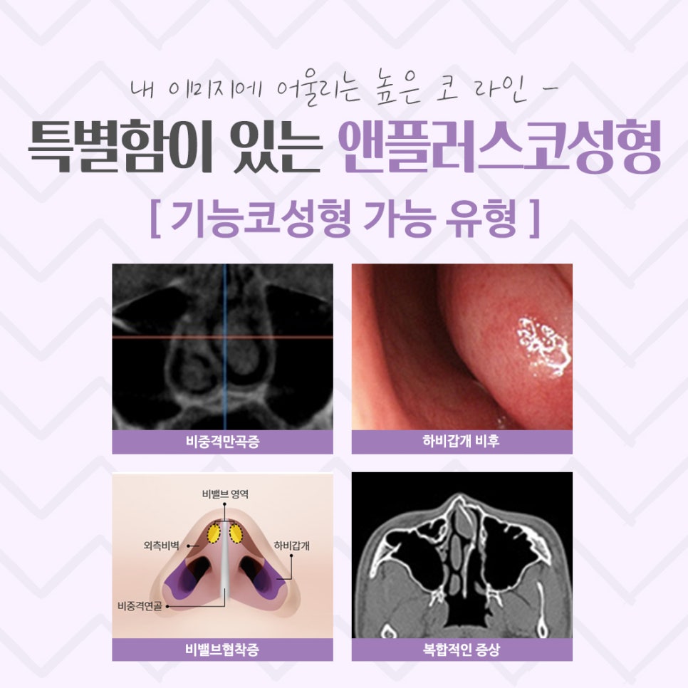 코수술후기를 통해 내게 어울리는 라인으로 관련 이미지 5