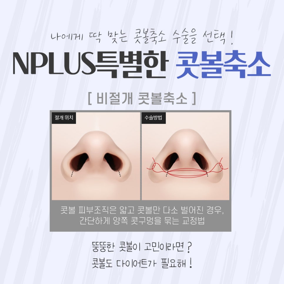 The Importance of Choosing a Nostril Reduction Review image 8