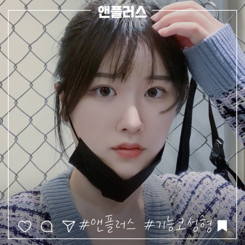 코성형후기 자연스럽고 예쁘게 관련 이미지 8