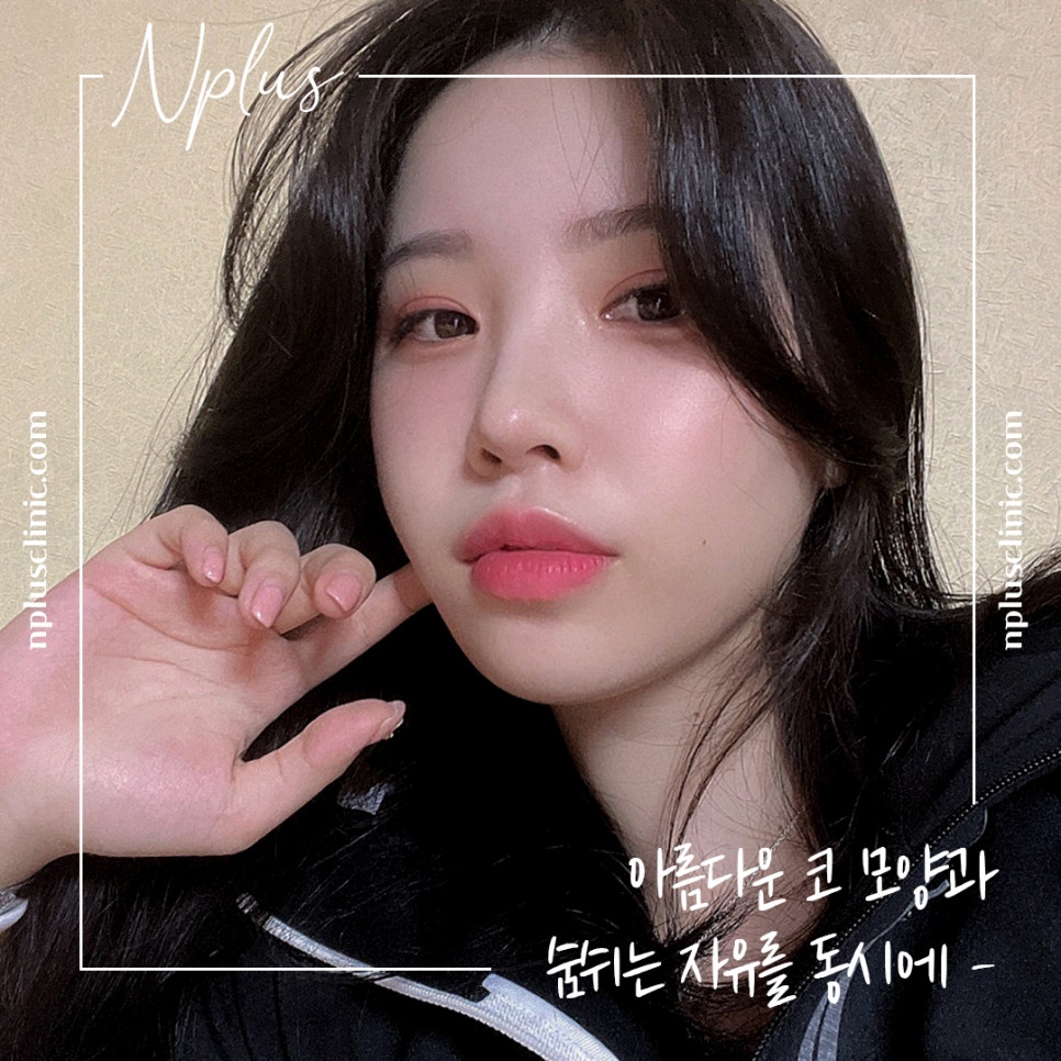 콧볼축소후기 섬세하게 알아보고 관련 이미지 7