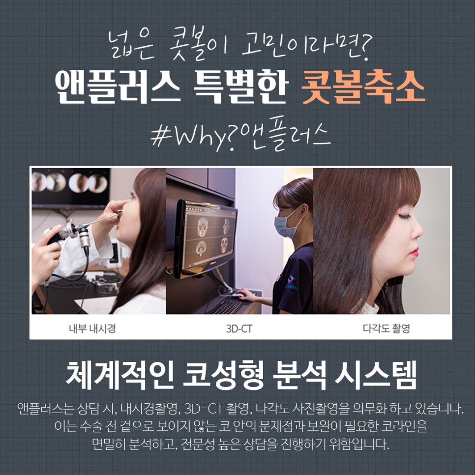 콧볼축소수술 흉터 없이 자연스럽게 관련 이미지 8