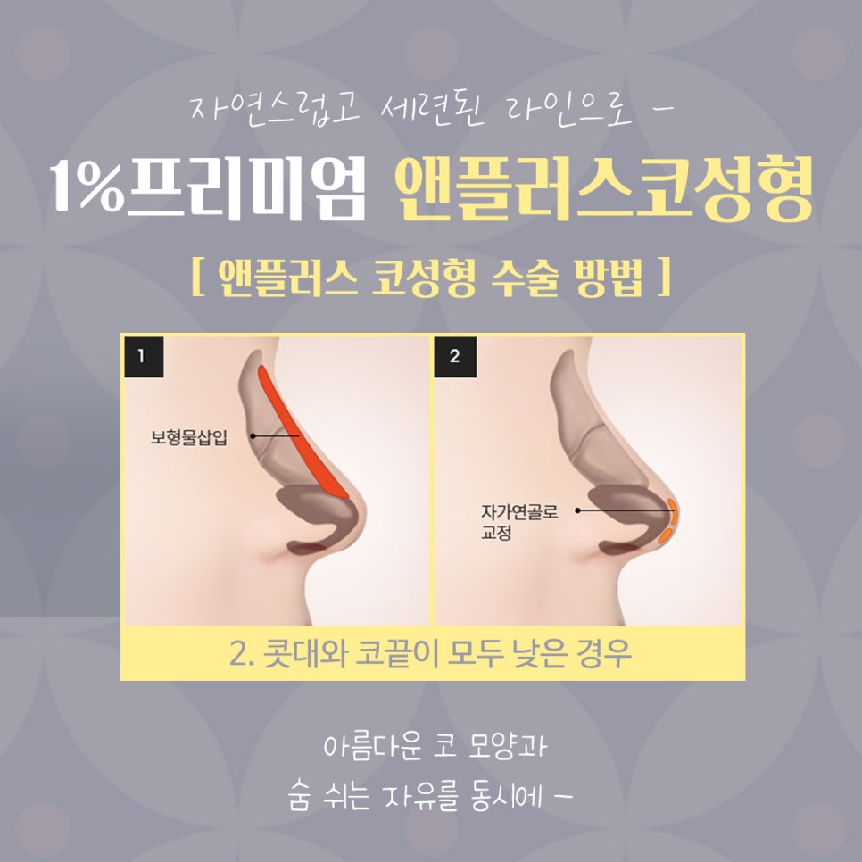 자가늑코수술 정확한 진단으로 관련 이미지 9