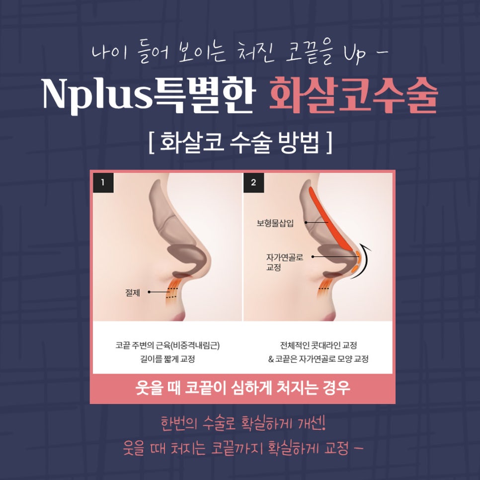 Transforming Your Look to a More Youthful Appearance After Arrow Nose Surgery image 7